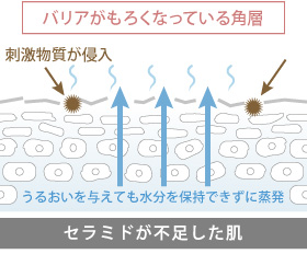 セラミドが不足した肌