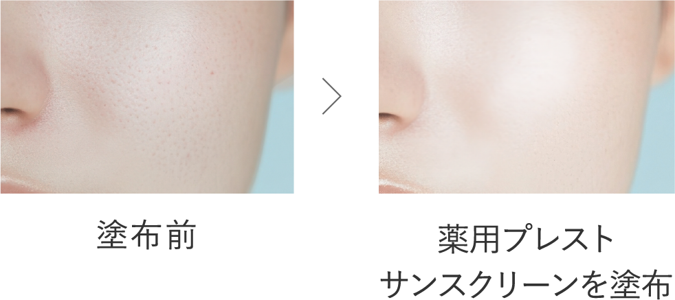 塗布前 ＞ 薬用プレストサンスクリーンを塗布